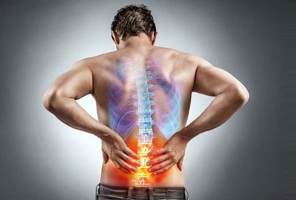 Hình ảnh đau lưng giữa cột sống ở bệnh nhân